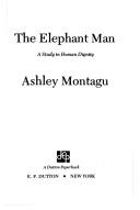 Cover of The elephant man
