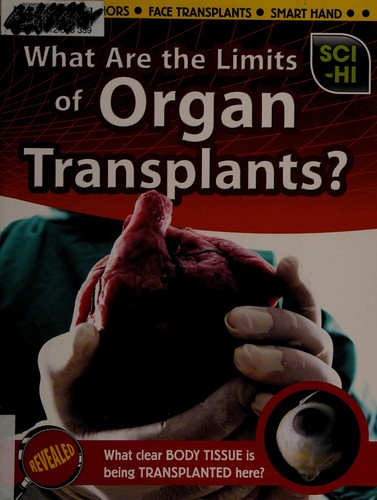 Cover of What Are the limits of organ transplants?