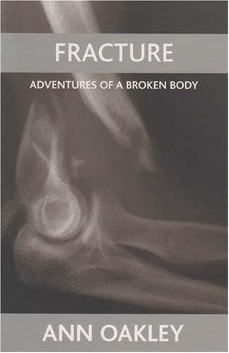 Cover of Fracture